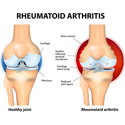 港人北上深圳植髮：專業可靠嘅選擇