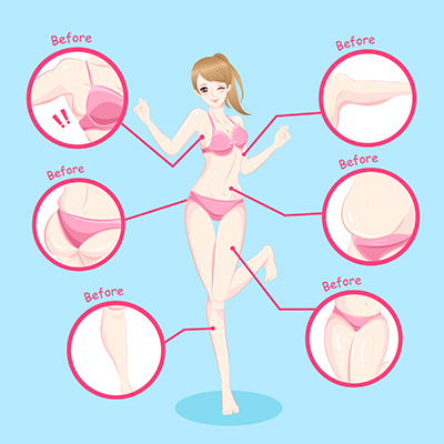 香港植髮邊度好？專業植髮科幫你解決脫髮問題